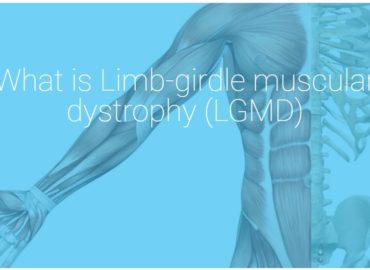 What is Limb-girdle muscular dystrophy type 2B (LGMD2B)